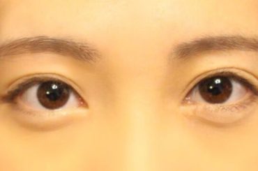 【女子必見】二重になりたいそこの君！！！