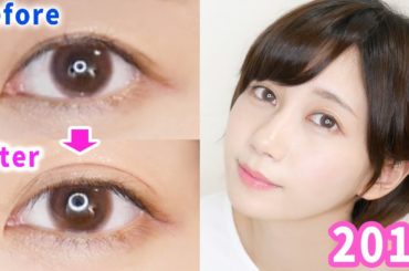 わたしの二重の作り方。【2018最新版】