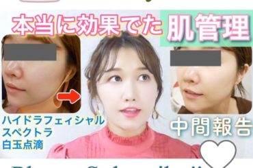 YouTube更新

2020年一回目の動画は
無加工の中間報告動画です

日本のクリニックで11月から毛穴を殺す為に笑
ハイドラフェイシャル
スペクトラ
白玉...