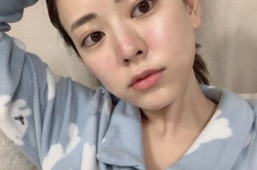 またまた新しい液を使ったのでダーマペン4レポ！
1枚目はDay1よる
2枚目はDay2朝
今回はダーマペン＋エクソソームという液を入れてもらいました！

エクソ...