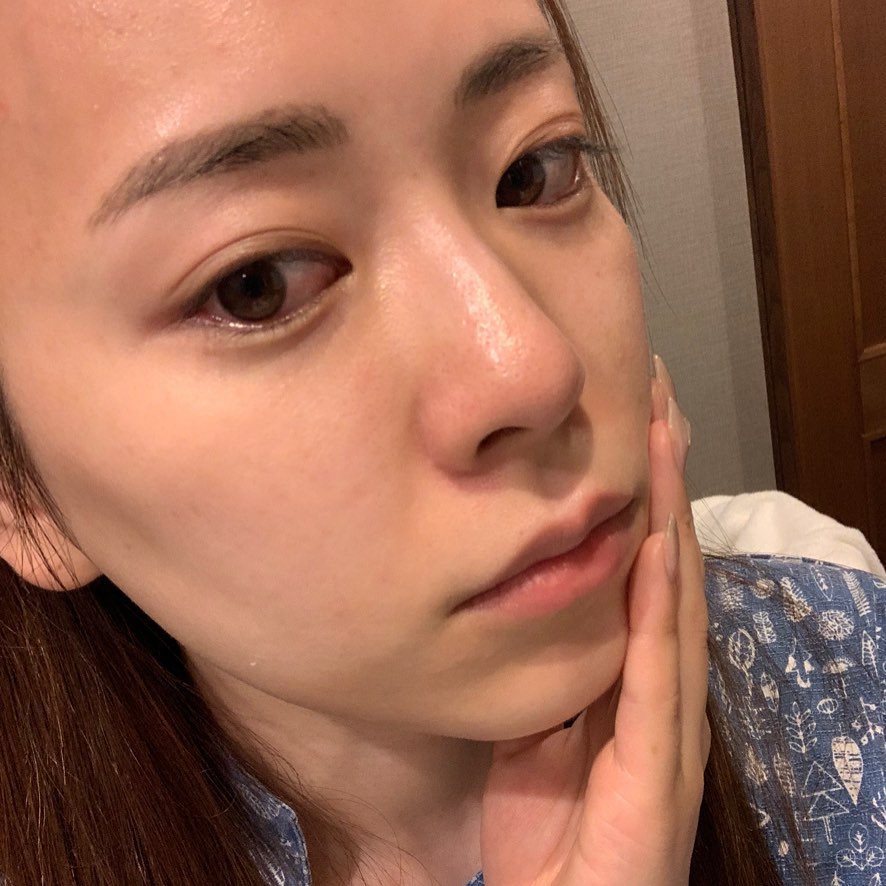 関根りさ 毛穴のひらき つまりで悩んでるってコメントを本当によくもらうんだけど 今までやって1番効果あったかもという毛穴ケアに出会った 青山ヒフ科クリニックて Moe Zine 関根りさ 毛穴のひらき つまりで悩んでるってコメントを本当によくもらうんだけど 今までやって1番効果あったかもという毛穴ケアに出会った 青山ヒフ科クリニックて Moe Zine
