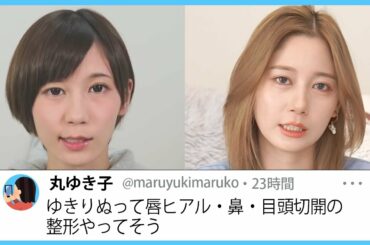 整形について。