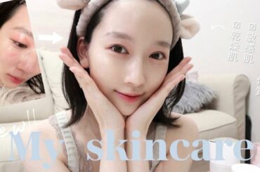 【美肌スキンケア】季節の変わり目で揺らぎやすい方に！アトピー肌、敏感肌、乾燥肌のお手入れ方法！🪄