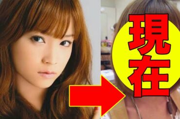 亀井絵里、卒業後の今現在が美人すぎると話題に！