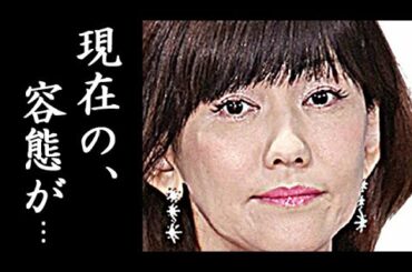 松本伊代が活動自粛を覚悟した理由に耳を疑う...ヒロミと結婚した歌手が落とし穴で骨折した後の現在とは...