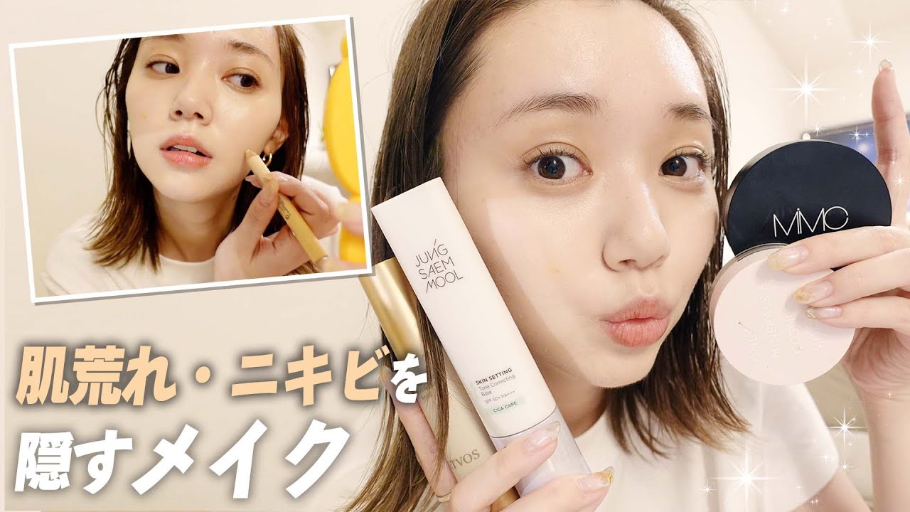 【スキンケア】肌荒れ・ニキビを隠すメイク術! 【スキンケア】肌荒れ・ニキビを隠すメイク術!