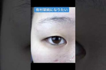 【二重埋没】二重の整形で有村架純になった女性 #shorts