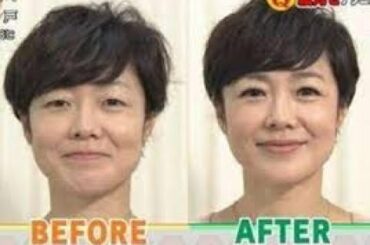 有働由美子アナ　右手首に大きな包帯、理由明かし苦笑「においを抑えられないのよ」