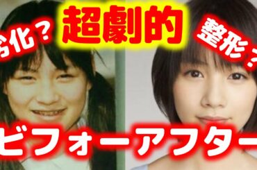 能年玲奈も！超絶！劣化？整形？芸能人超絶劇的ビフォーアフター！深瀬慧,錦戸亮,能年玲奈,鈴木奈々,生田斗真etc.【芸能おもクロ秘話ニュース】