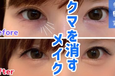 クマがひどい時のメイク！