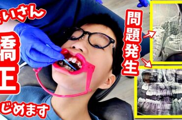 せいさん 矯正をはじめる😁 が、レントゲンを撮ったら問題が・・・どうなる❓