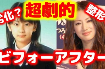 北川景子も・・・超絶！劣化？整形？芸能人超絶劇的ビフォーアフター！川島海荷,菜々緒,北川景子,BOA,神田うのetc.【芸能おもクロ秘話ニュース】