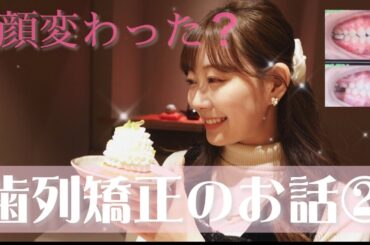 【渡辺美優紀】歯列矯正のお話②【みるきー】