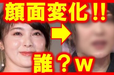 整形？高畑充希と貫地谷しほりの顔が変わりすぎ！ビフォーアフター！二重ラインが…鼻の形が…