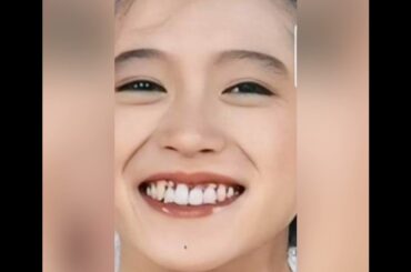 中森明菜は入れ歯だった！中森明菜付け歯