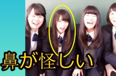 可愛いけど目と鼻は整形！？桜井日奈子に批判の嵐…