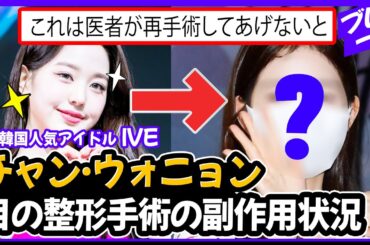 韓国アイドルのチャンウォニョン、顔に欲を出して結局整形手術失敗に終わった！ 信じられない雪の状態！ [IZ*ONE / IVEチャンウォニョン] アイブ