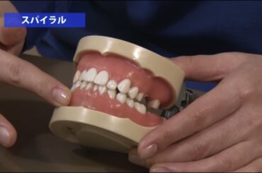 デンタルエステ　口腔内