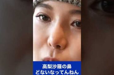 高梨沙羅の鼻がヤバぅぃ！