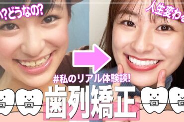 【歯列矯正】歯並び良くなかった私がワイヤー矯正したらこうなった🦷！全て話します！