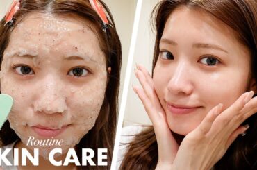 【スキンケア】すっぴんの肌がレベチになる!! 最近の美白ケアルーティン【最近のお肌事情も】