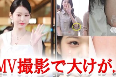IVEウォニョンがMV撮影中に大けがを負ったことが分かりファン激怒...