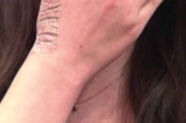 【閲覧注意】川栄李奈の親指が包帯無しで放送される