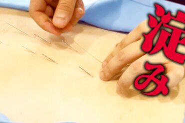 【鍼治療】鍼治療で肩こり改善！施術後は患者さんも驚きの変化が！