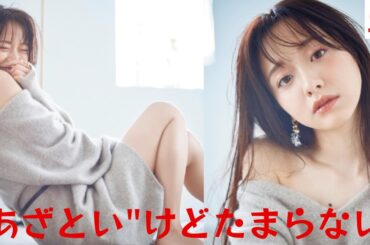 森香澄、セクシーな胸元のほくろに"あざとい"けどたまらない