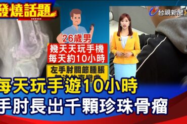 每天玩手遊10小時 手肘長出千顆珍珠骨瘤【發燒話題】-20231203
