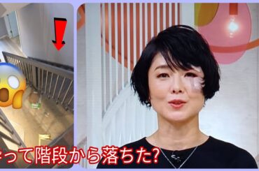 有働由美子アナが顔に絆 創膏!酔って怪我? - 有働 由美子 怪我 - 有働 由美子 今日 - 有働 由美子 絆創膏 - Yumico Udo scary facial Injury Video