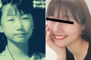 整形がバレバレな女性芸能人８選