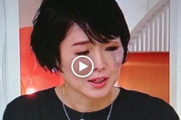 有働由美子アナ顔面に絆創膏痛々しい姿でnews zero卒業報告「この顔で言われてもねぇ」|| 有働由美子アナが顔に絆 創膏!酔って怪我? - 有働 由美子 怪我 - 有働 由美子 今日 - 有働