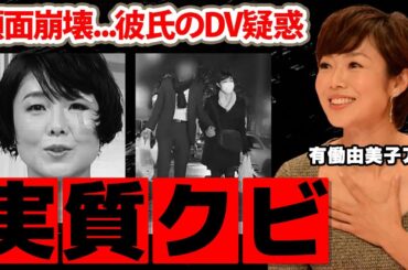 【news zero】有働由美子アナの降板が実質クビの真相...大怪我で顔面崩壊した本当の理由に驚愕！熱愛彼氏のＤＶ疑惑の実態がヤバすぎた！【日本テレビ】