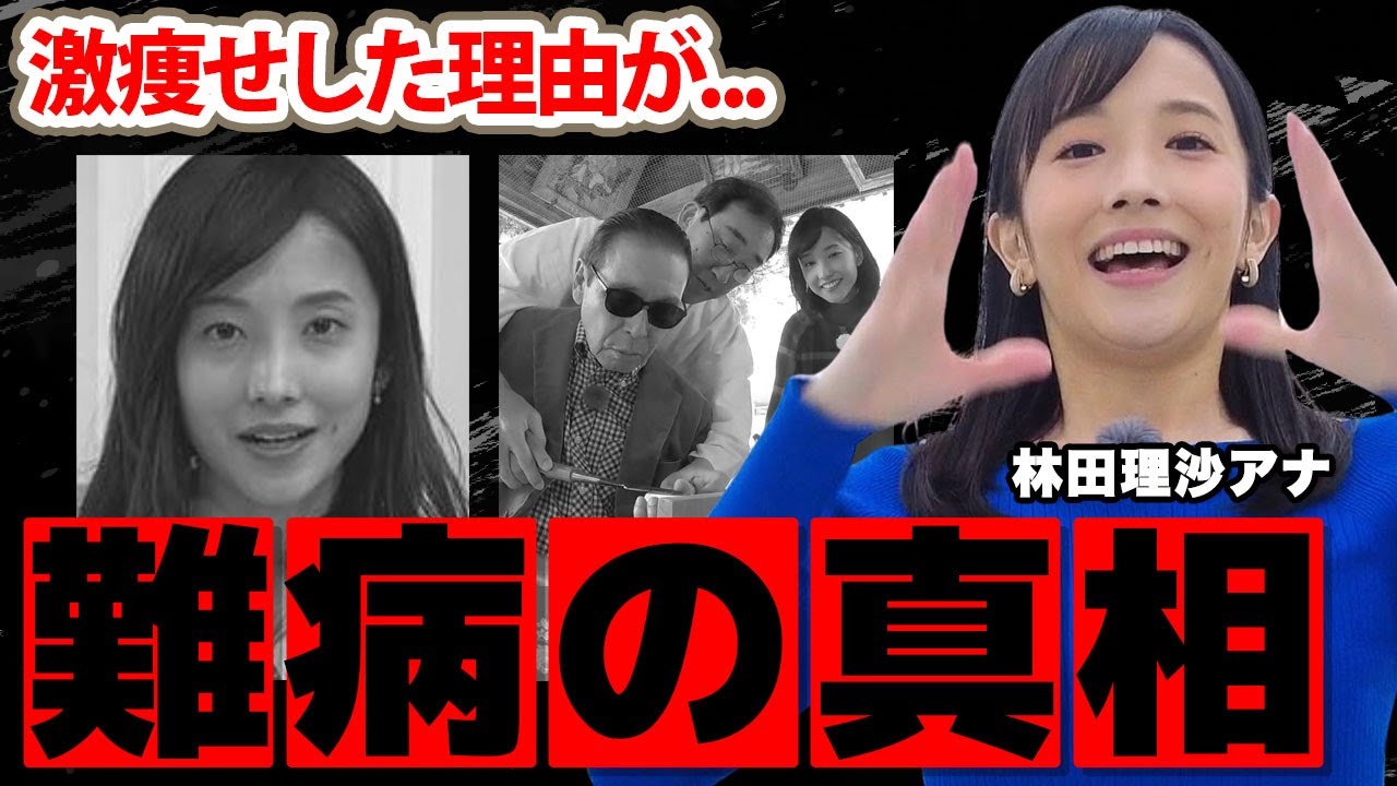 【NHK】林田理沙アナの抱える病気…激痩せした理由に驚愕!「リンダ」の愛称で人気の女子アナの年収…家族の職業がヤバすぎた! 【NHK】林田理沙アナの抱える病気...激痩せした理由に驚愕!「リンダ」の愛称で人気の女子アナの年収...家族の職業がヤバすぎた!