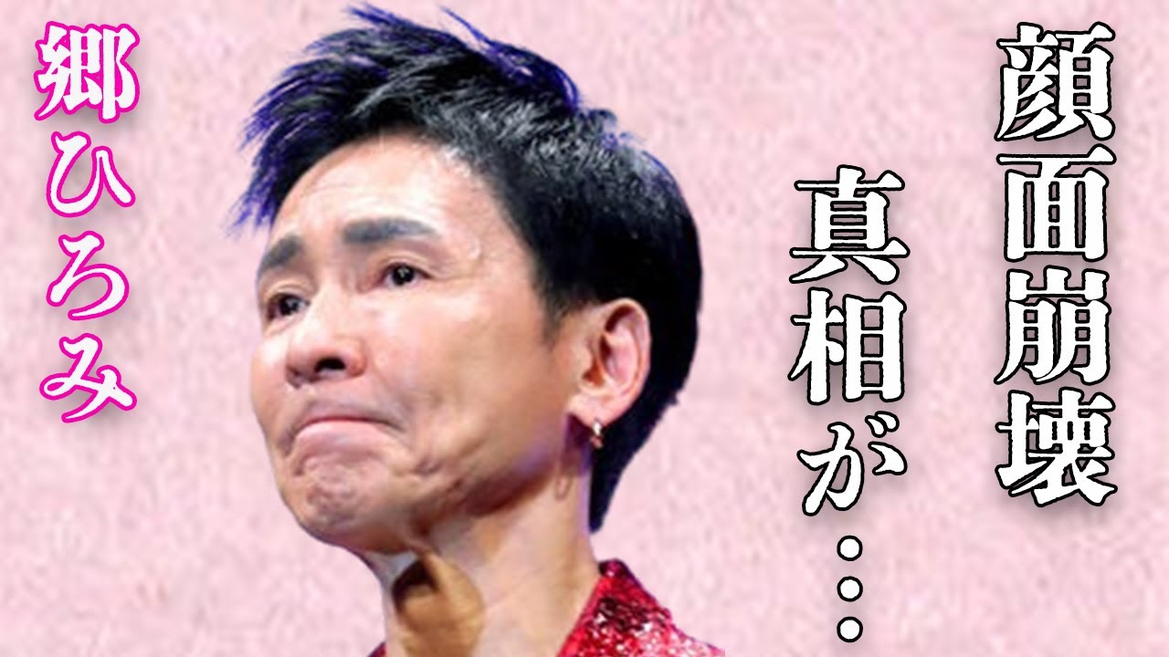 郷ひろみの“顔面崩壊”と言われる原因…自身で語った“下”事情に言葉を失う…「2億4千万の瞳」でも有名な歌手が松田聖子と結婚しなかった理由に驚きを隠せない… 郷ひろみの“顔面崩壊”と言われる原因…自身で語った“下”事情に言葉を失う…「2億4千万の瞳」でも有名な歌手が松田聖子と結婚しなかった理由に驚きを隠せない…