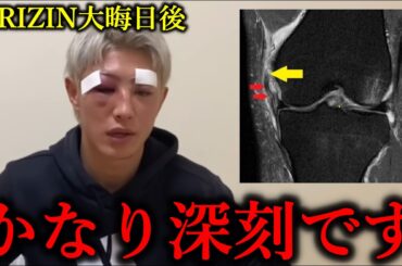RIZIN45で篠塚辰樹と戦いとんでもない重傷を負ったことを明かす冨澤大智【BreakingDown/朝倉未来】