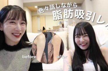 妹のコンプレックスを解消してきました！【二の腕の脂肪吸引レポ】術前から2ヶ月後のダウンタイムまで詳しくお話します✨