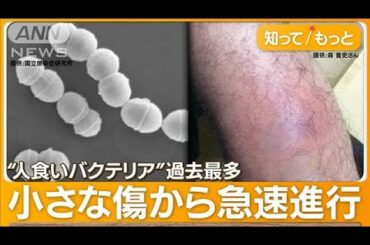 “人食いバクテリア”過去最多　致死率3割…「死を覚悟」片足失った男性　感染経路は【知ってもっと】【グッド！モーニング】(2024年1月22日)