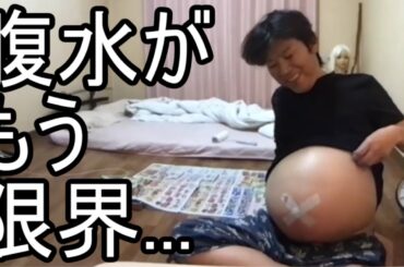 【金バエ】悲報 腹水が限界を超えている事を語る【肝不全 余命1年】 2024/01/12