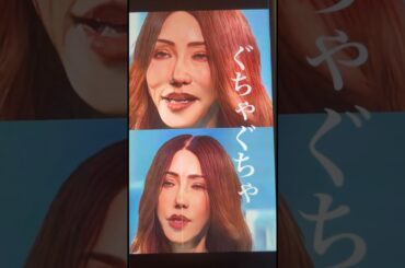 とあるオネエ系タレントが両顎手術と鼻整形した結果、現在のご尊顔が大変なことに。。。