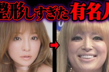 整形しすぎてヤバいことになったアイドル 93選【ゆっくり解説】【総集編】