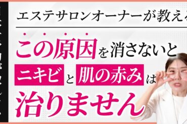 【悲報】この原因を消さないと肌の赤みとニキビは消えません【スキンケア】