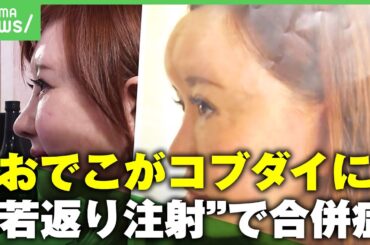 【施術後に肥大化】“切らずにしわ取り”手軽さで広がるPRP+bFGF注射 目的外使用に注意喚起も｜アベヒル