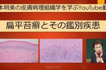 扁平苔癬と鑑別疾患の解説　#dermatopathology  #山本明美  #扁平苔癬　#Lichenplanus