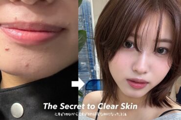 実は肌荒れ地獄で悩んでいた私が「超肌キレイ」と言われるまでになれたたった1つの方法【美肌】