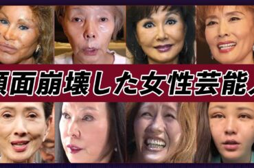 【衝撃画像】顔面崩壊した女性芸能人・有名人25選【※多重整形・整形失敗・事故】