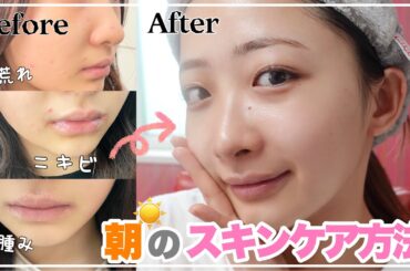 【モーニングルーティン】朝のスキンケア方法を紹介✨【むくみ取り/朝用洗顔/おすすめの美容コスメ】