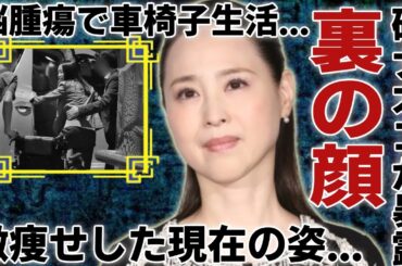 松田聖子の親友としての研ナオコが暴露した昭和のスーパーアイドルの裏の顔に一同驚愕...！「赤いスイートピー」で有名な彼女が”脳腫瘍”で激痩せした現在の姿に言葉を失う...