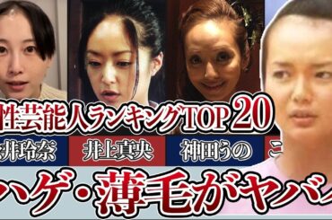 【衝撃ハゲ画像】ハゲが気になる女性芸能人衝撃ランキングTOP２０！